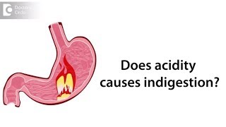 What is Hyperacidity Does acidity causes indigestion  Dr Syed Naveed Azam [upl. by Onnem513]