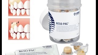 ResoPac ® by Hager amp Werken  Wundschutzpasteperiodontal dressing [upl. by Alliuqet996]