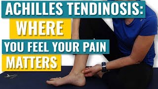 Achilles Tendonitis  Where you Feel your Pain Matters [upl. by Cousin487]