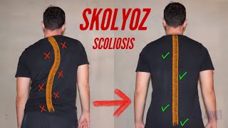 Skolyoz İçin 4 Egzersiz  4 Scoliosis Exercises [upl. by Assirk469]