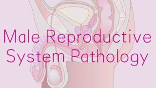 Male Reproductive System Pathology 3  Benign Prostatic Hyperplasia 2 [upl. by Gnel]