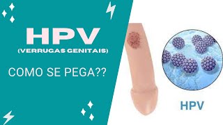 HPV Como pega e qual seu tratamento [upl. by Sacksen289]