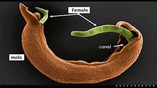 Trematoda 3 Schistosoma [upl. by Budwig]