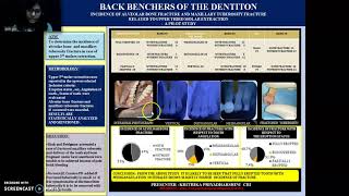 INCIDENCE OF ALVEOLAR BONE FRACTURE amp MAXILLARY TUBEROSITY FRACTURE RELATED TO MAX MOLAR EXTRACTION [upl. by Suoicul]