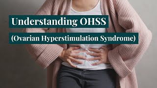 Ovarian Hyperstimulation Syndrome  OHSS Symptoms Treatment and Fertility [upl. by Januisz]