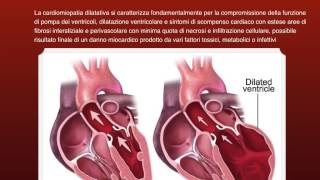 Patologie dellApparato Cardiovascolare [upl. by Nerty]