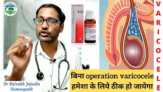 Homeopathic medicine for varicocele varicocele treatment without surgery [upl. by Relyks412]