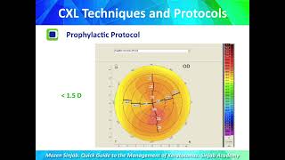 Quick Guide to the Management of Keratoconus Part 11 [upl. by Gaither]