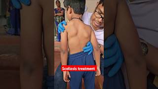 Scoliosis treatment drrajneeshkant worldfamouschiropractor [upl. by Peih]