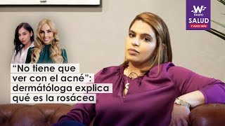 “No tiene que ver con el acné” dermátóloga explica qué es la rosácea [upl. by Kcirdef]