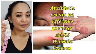 Antibiotic Cream na Effective treatment  Para sa Wounds ACNE at Eczema [upl. by Letta]