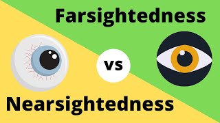 Difference between Myopia  Near Sightedness and Hyperopia  FarSightedness [upl. by Callahan]