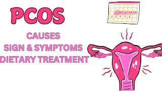 Polycystic Ovary Syndrome  PCOS  Causes  Sign  Symptoms amp Dietary Treatment [upl. by Gladdy395]