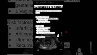 Subchorionic hematoma [upl. by Havard41]