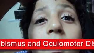 Chronic Progressive External Ophthalmoplegia  شلل عضلات العين [upl. by Imailiv]