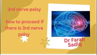 3rd nerve palsy  short case neuro case presentation and discussion  paces fcps med [upl. by Valma]