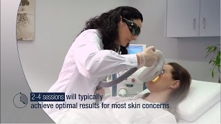 Lumenis Optima IPL Treatment  Waiting Room Video [upl. by Nosyla397]