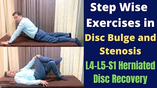 Exercises For Herniated Disc Disc Bulge L4L5S1 Step Wise Treatment for Slipped Disc Recovery [upl. by Llirret960]