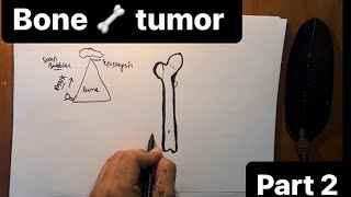 Bone tumor Pathalogy HINDI 🍖 GIANT CELL TUMORbenign and malignant part2 [upl. by Jess]