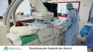 AngiographieAnlage HighEndMedizin im Medizinischen Zentrum Städteregion Aachen [upl. by Asusej105]