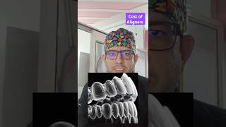 Cost of Aligners  What are Aligners  Briefly explained smile viralvideo youtubeshorts [upl. by Ysdnil]