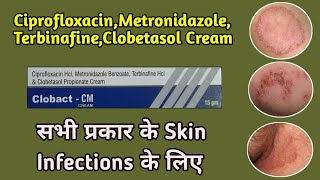 Ciprofloxacin metronidazole terbinafine clobetasol propionate CreamClobact cm cream  Dawa jankari [upl. by Avek]