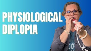 Physiological Diplopia Explanation and Treatment  Advanced Vision Therapy [upl. by Adyht]