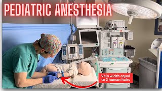 Why anesthesia for children is so different [upl. by Inahpit]