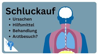 Schluckauf Alles über Ursachen und wann du zum Arzt solltest  Anatomie2Go [upl. by Weinman660]