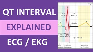 QT Interval Explained ECG  EKG Interpretation Nursing NCLEX [upl. by Ahtamat]