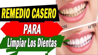 En apenas 3 minutos esta mezcla promete eliminar la placa dental y sarro  Belleza [upl. by Imotih]