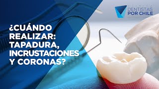 🤔¿TAPADURA DENTAL INCRUSTACIÓN o CORONA❓❓  Cuando y CÓMO elegir la correcta [upl. by Oiralednac59]