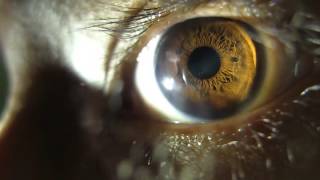 Pupil Dilating eye changing apeture HD [upl. by Bertrando270]