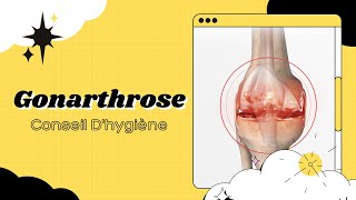 🟡  Gonarthrose  Conseil Dhygiène [upl. by Routh417]