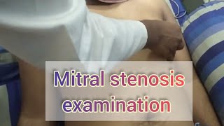 Mitral stenosis examination  murmur examination  sanowarhossain1290 [upl. by Siobhan242]