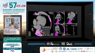 CT Arteriography All What You Need To Know [upl. by Eido]