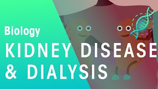 Kidney Disease and Dialysis  Health  Biology  FuseSchool [upl. by Ahseik]