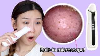 Blackhead Vacuum Suction with Builtin Microscope [upl. by Janaya]