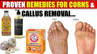 14 Proven Home Remedies For Corns amp Callus Removal THAT WORK  Natural Foot Care Tips  Amazing Tips [upl. by Yltneb]