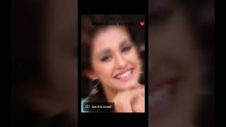 Before plastic surgery❤️song bollywood bollywoodsongs trending viralshort shorts dishapatani [upl. by Allerbag]