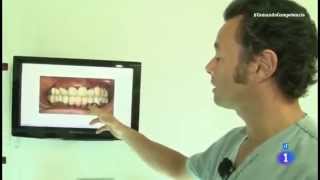 Reportaje  Precio y calidad de implantes dentales  Comando actualidad [upl. by Elamef]