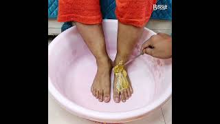 Hands Feet Whitening DiyInstant Hands Feet Whitening Home Remedies Feet Whitening Formula [upl. by Glasgo761]