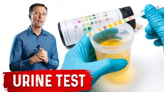 Urine Test Simplified [upl. by Clippard]