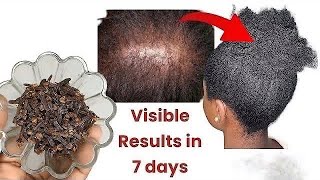 MASSIVE HAIR GROWTH in ONE MONTH with THIS Simple Trick [upl. by Federico]