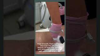 Laser Hair Removal MD Laser Clinic Burlingtonburlington laser hairremoval injectables [upl. by Sherrard527]