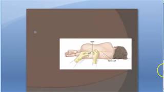 Pathology 999 c Tuberculous meningitis CSF Mycobacterium lymphocytes Case Study [upl. by Singhal]