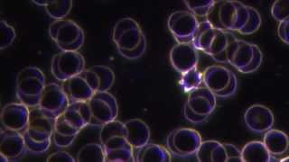 Rickettsia bacteria free in blood [upl. by Noside823]