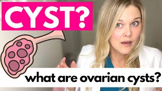 OVARIAN CYSTS What Causes Ovarian Cysts [upl. by Kazue]