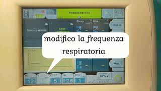 NIV Come impostare il ventilatore in pressione controllata [upl. by Ynalem]