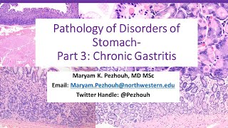 Part 3 Pathology of Gastric Disorders Chronic Gastritis [upl. by Ybloc664]